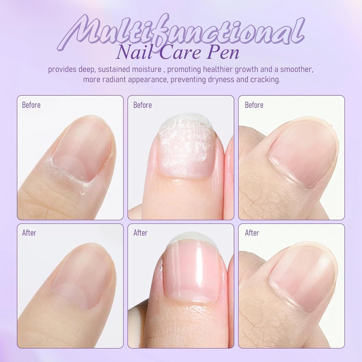 3-in-1 Cuticle Oil Pen, Cuticle Pusher Pen with Ceramic Tip, Upgraded Rotary Oil Discharge Portable Nail Care Pen Cuticle Remover for Hangnails Dry & Damaged Nails, Moisturize Strengthen(1pc)