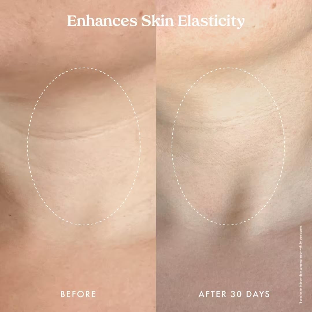 Kopari Ultra Restore Firming Body Serum with Dual Peptide Complex, Deeply Hydrates, Improves Skin Tone & Texture, Firms & Enhances Elasticity, 5 oz