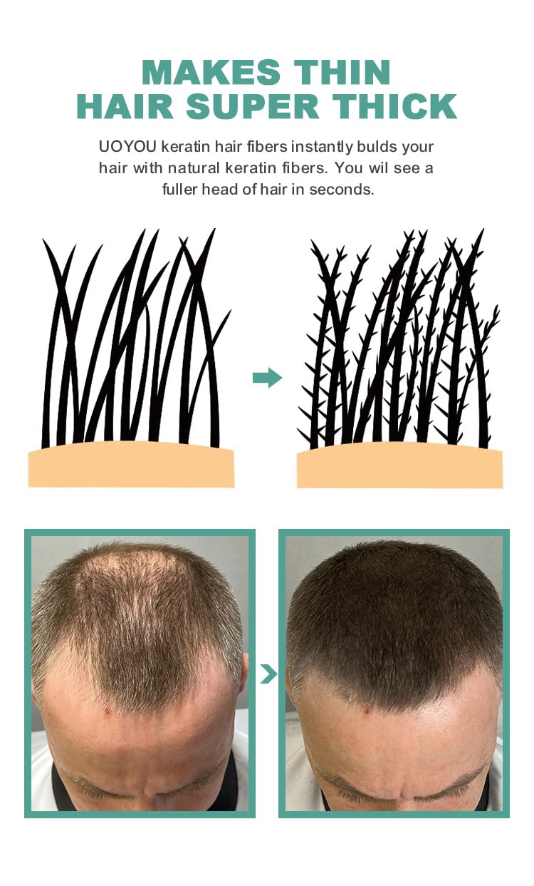 GREY Hair Fibers for Thinning Hair 27.5g Bottle | Undetectable & Natural Keratin Hair Fibers Concealer for Hair Loss for Men and Women | Hair Building Fibres Powder [GREY]