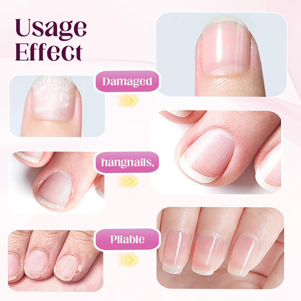 Upgrade 3-in-1 Nail Care Pen, 2025 Cuticle Pusher with Ceramic Tip for Hangnails, Dry & Damaged Nails, Nail Cuticle Remover Pens, for Moisturize Strengthen Nails (3 PCS)