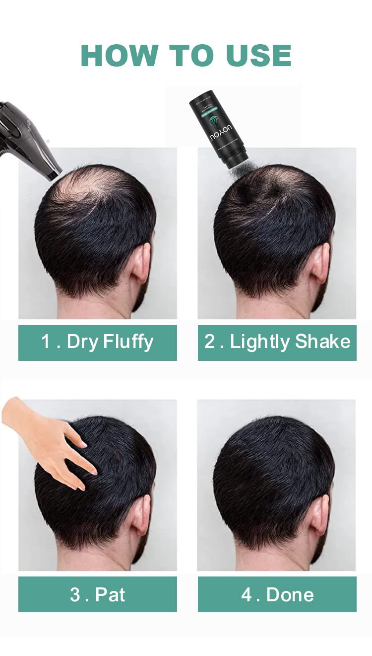 MEDIUM BROWN Hair Fibers for Thinning Hair 27.5g Bottle | Undetectable & Natural Keratin Hair Fibers Concealer for Hair Loss for Men and Women | Hair Building Fibres Powder [MEDIUM BROWN]