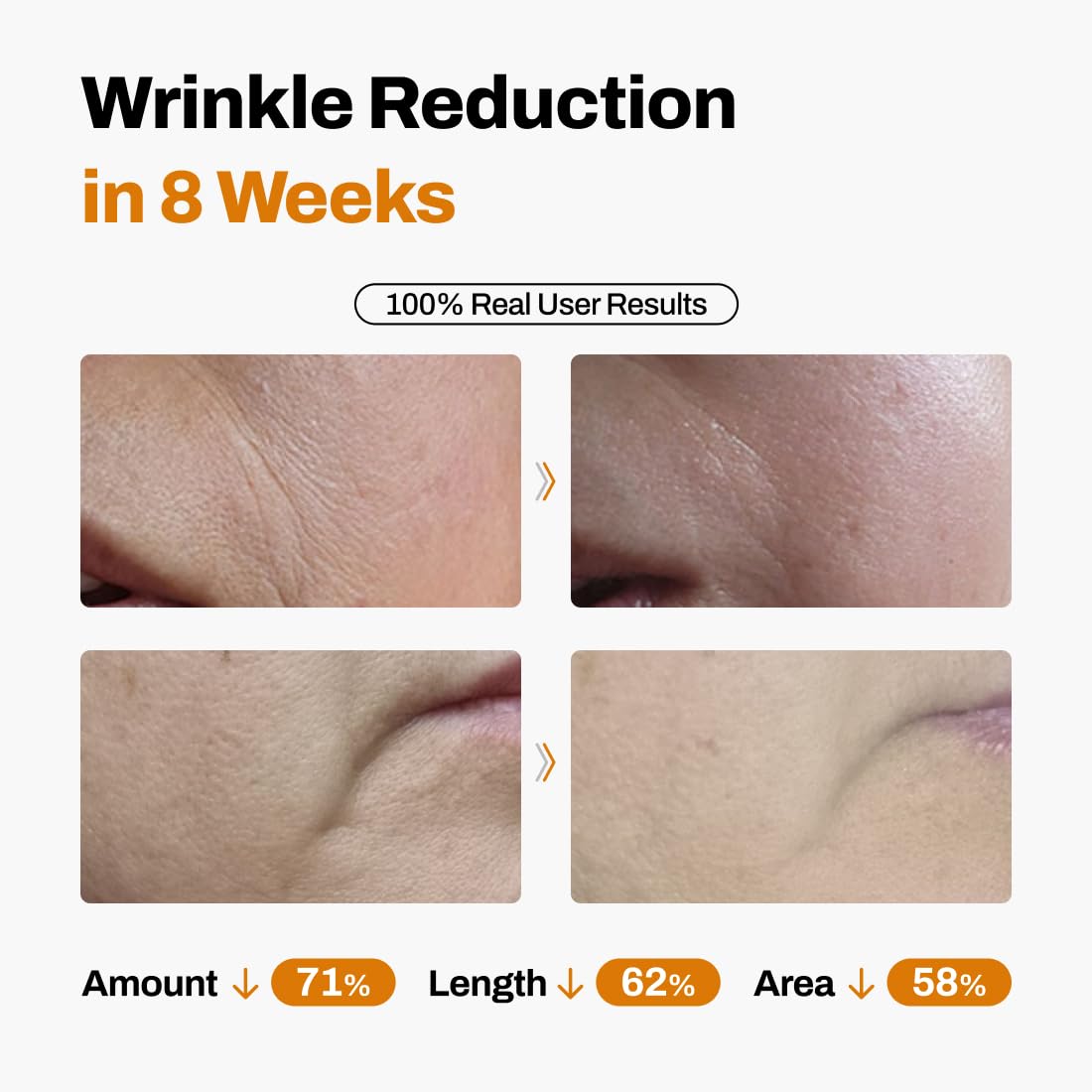 JEU'DEMEURE DermiShuttle Lifting Kit - Anti Aging Serum, Face Serum for Firming, Anti Wrinkle, Skin Elasticity, Hydrating with Collagen, Peptides, Korean Skincare (8 Weeks)