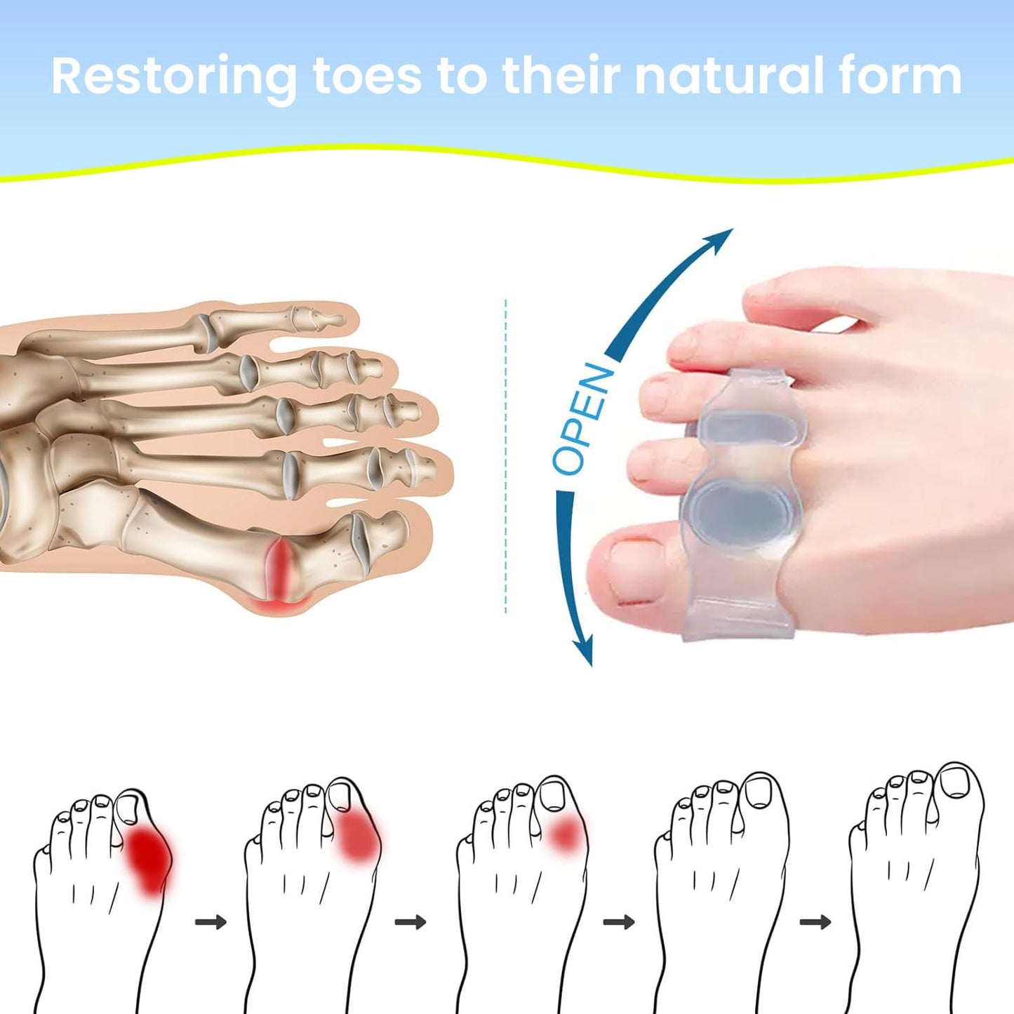 Toe Separators for Correcting Bunions and Restoring Toes to Their Original Shape for Men and Women – Toe Spacers Bunion Corrector (Light Blue)