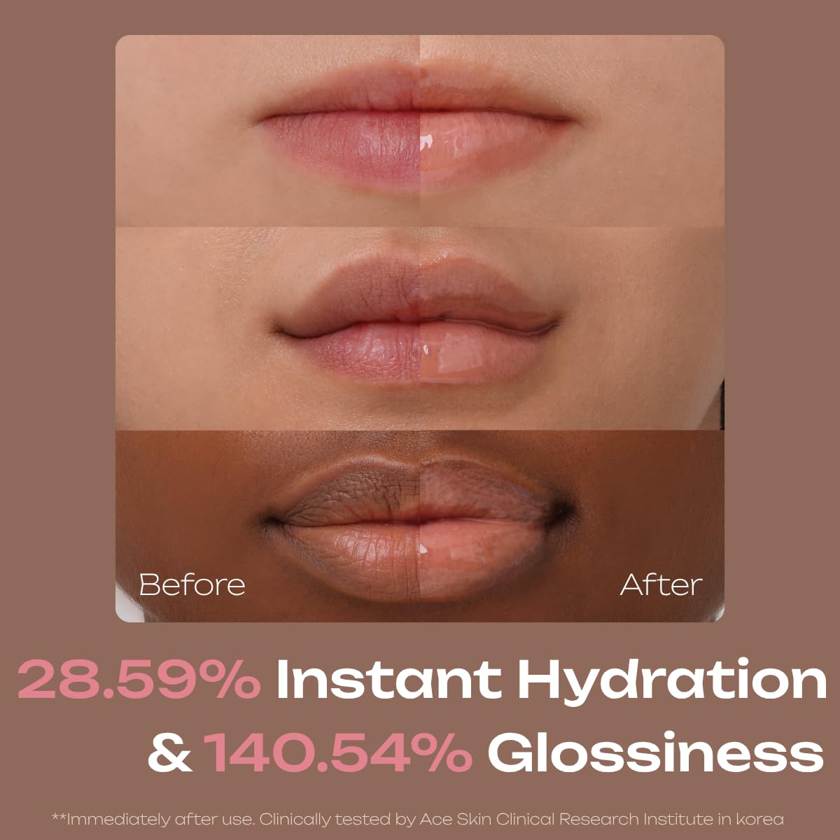 PDRN Tinted Lip Serum – High Gloss Ultra Hydrating Natural Glow, Non-Sticky Volumizing Color Glaze with Long-Lasting Shine, Nourishing Moisturizing Repair for Chapped Lips (0.34 oz) (island)