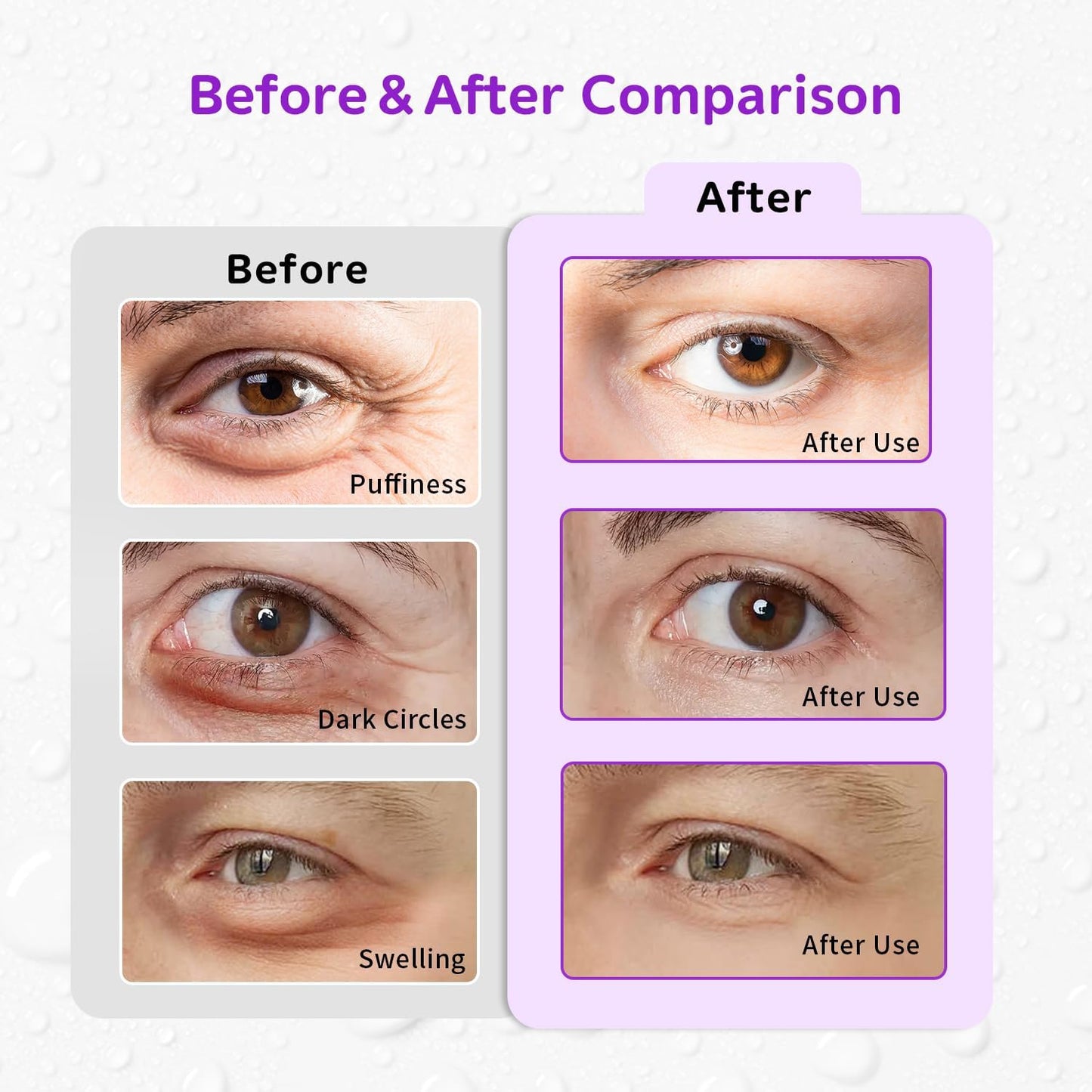 4PCS Gel Eye Ice Pack Set, Cold & Hot Compress, Reusable Cooling Gel Pads for Strain Relief, Relaxation, SPA and Sleep (4 Grapes)