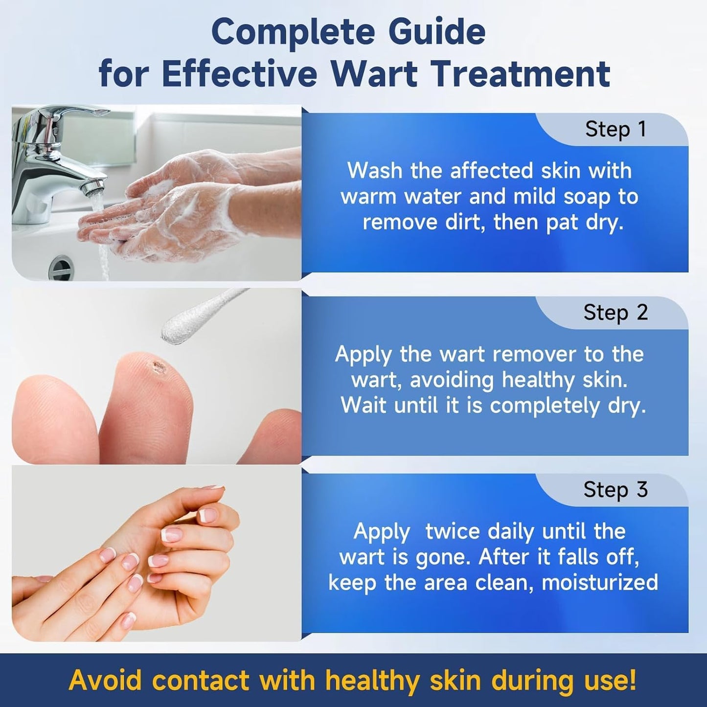 Fast-Acting Skin Tag Remover Wart Remover with Salicylic Acid, Wart Removal for Women Men, Wart Freeze Off for Plantar Wart, Flat, Common, Corn,H Wart, Callus 30ML