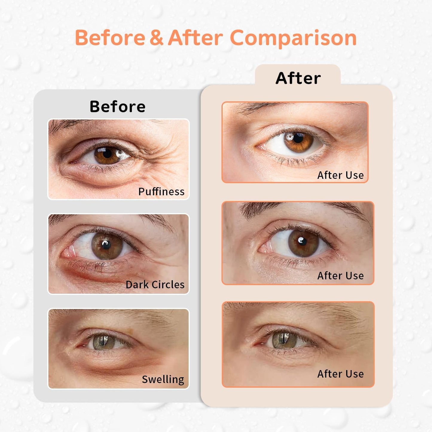 4PCS Gel Eye Ice Pack Set, Cold & Hot Compress, Reusable Cooling Gel Pads for Strain Relief, Relaxation, SPA and sleep(Oranges)