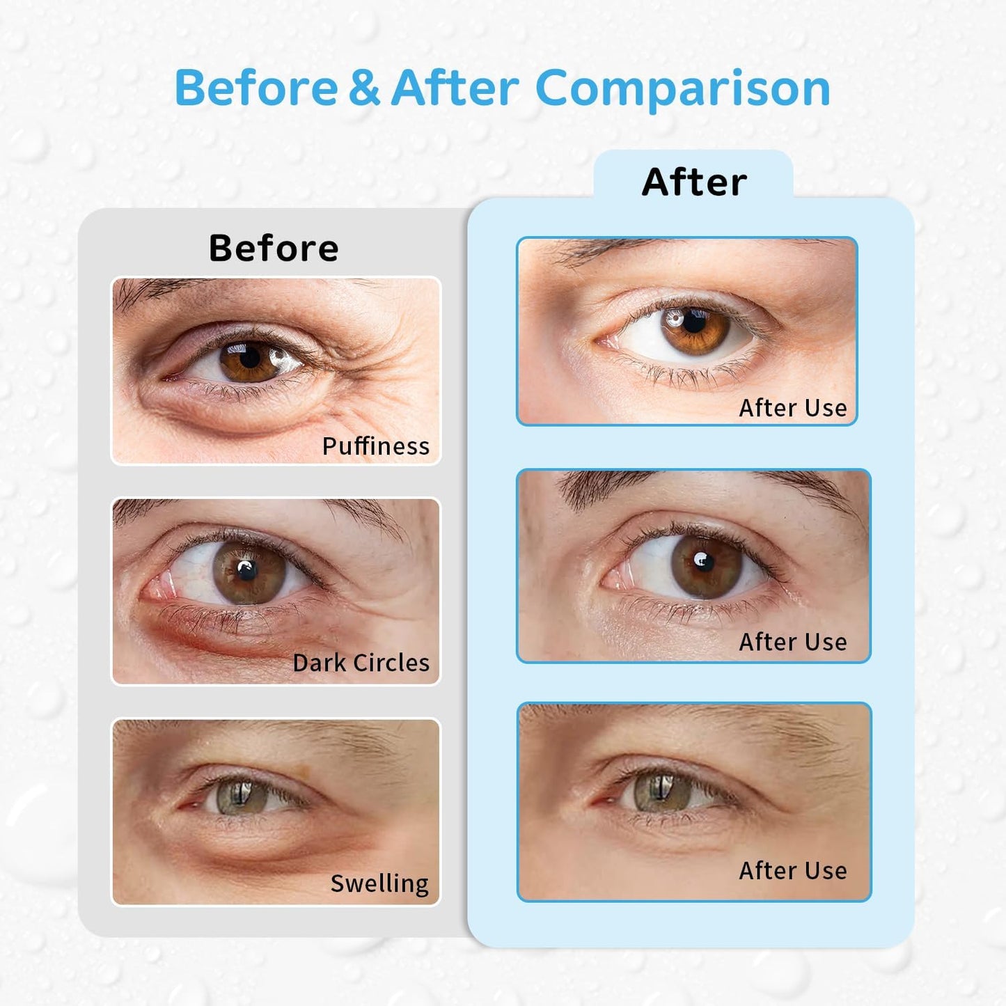 4PCS Gel Eye Ice Pack Set, Cold & Hot Compress, Reusable Cooling Gel Pads for Strain Relief, Relaxation, SPA and Sleep (4 Blue Flowers-2)