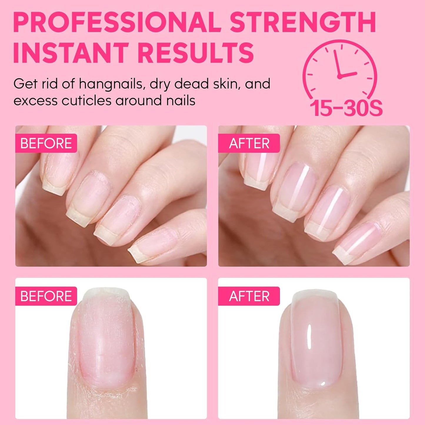 Cuticle Remover Kit - Cuticle Remover Cream & Cuticle Oil, Rose Flavor Cuticle Care Kit with Cuticle Trimmer Cuticle Pusher Cuticle Nipper for Manicure, Removedor de Cuticula for Nail Care