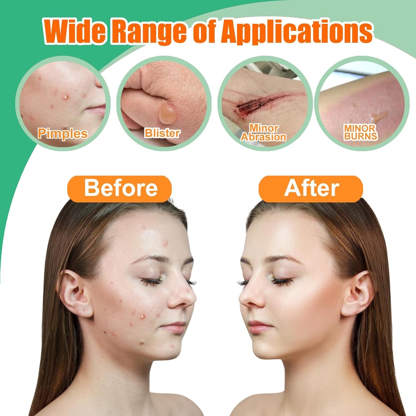 Hydrocolloid Roll for Wound Care – 2 in × 16 ft, Cut-to-Size Hydrocolloid Bandages, Extra Large Patch Tape, Ultra Absorbent, Waterproof & Flexible, First Aid Kit Essential