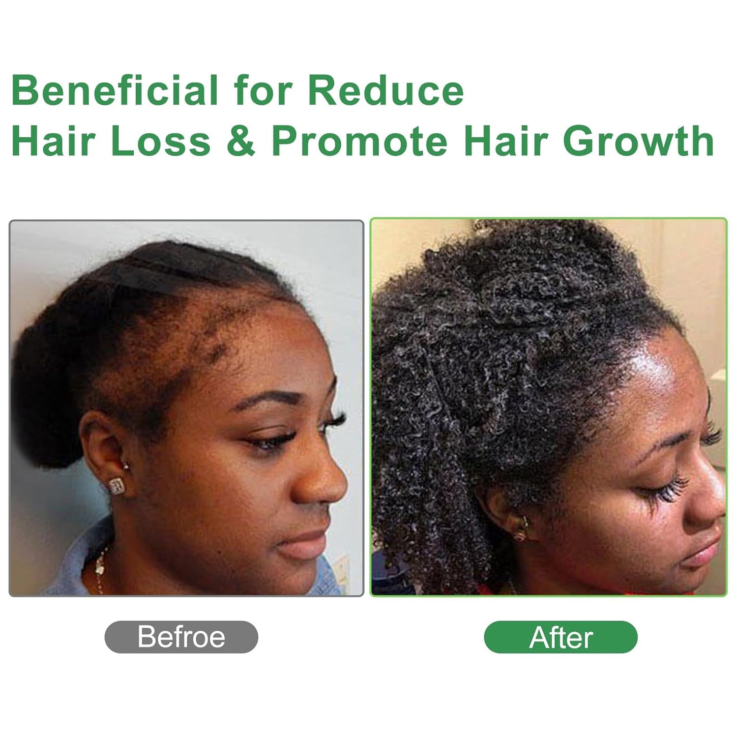 Jamaican Black Castor Oil - USDA Certified Organic Cold Pressed Hexane Free Unrefined, Natural Hair Oil For Treatment Scalp, Growth Hair Eyelashes Eyebrows (4oz/120ml Glass Bottle)