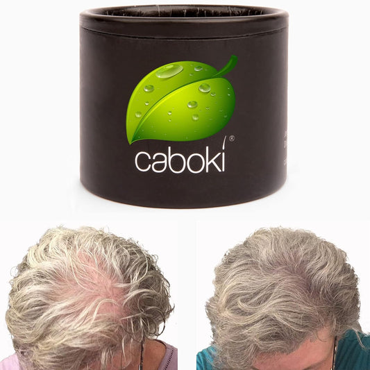 Hair Loss Concealer. Covers Bald Spot And Makes Thin Hair Look 10X Fuller Instantly. All-Natural Hair Building Fiber. Trial Size, 10-Day Supply. Gray