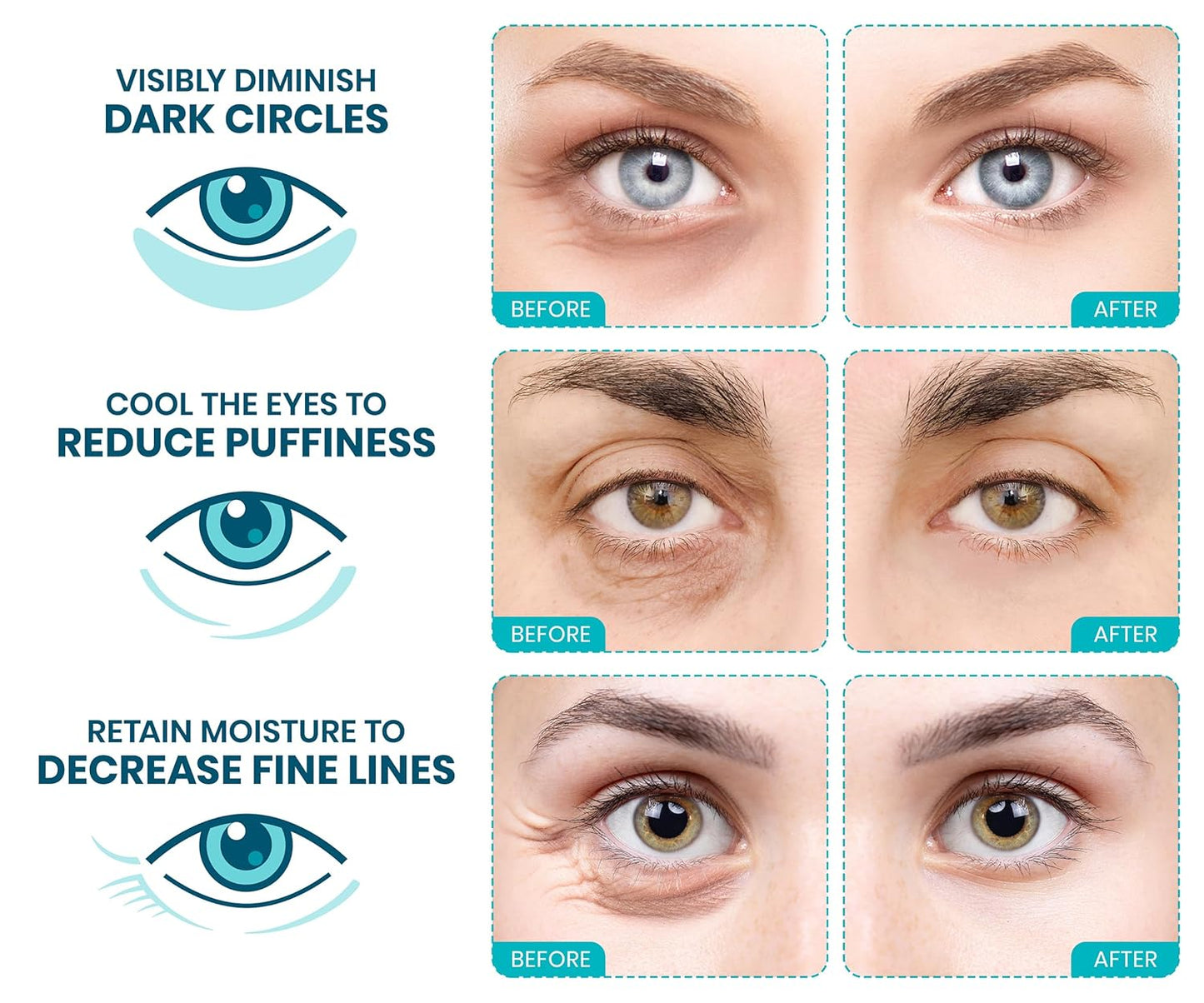 Stylia Under Eye Patches for Puffy Eyes and Dark Circles (12 Pairs) - Marine Collagen Under Eye Mask with Vitamin C, Hyaluronic Acid, Pearl Extract - Eye Masks for Dark Circles and Puffiness