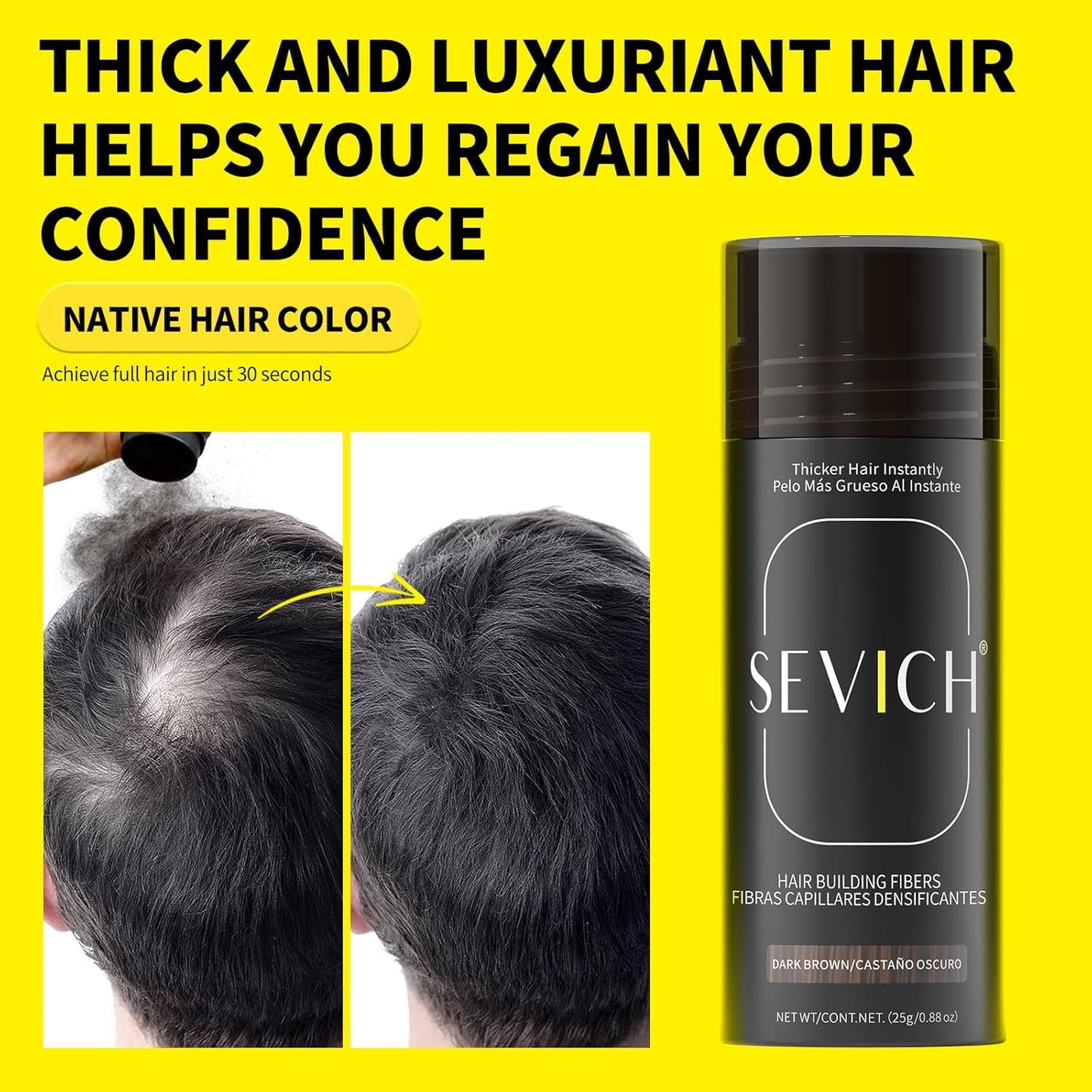 SEVICH Hair Fibers with Spray Applicator - Natural-Looking Hair Thickening Fibers for Men & Women, Instant Fullness, Wind & Water Resistant, Easy Wash Out, 25g (Medium Brown)